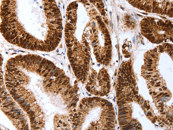 Rabbit Polyclonal Antibody to MAP2