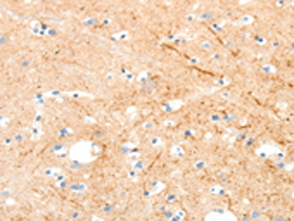 Rabbit Polyclonal Antibody to MAP4K1