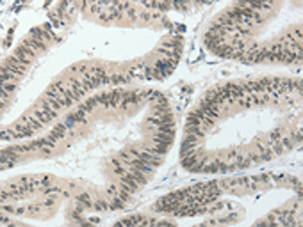 Rabbit Polyclonal Antibody to HNF1B
