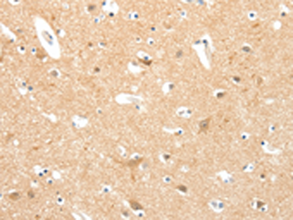 Rabbit Polyclonal Antibody to TIGAR