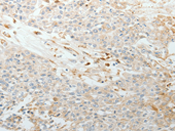 Rabbit Polyclonal Antibody to TNC