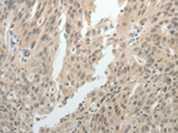 Rabbit Polyclonal Antibody to TOP1MT