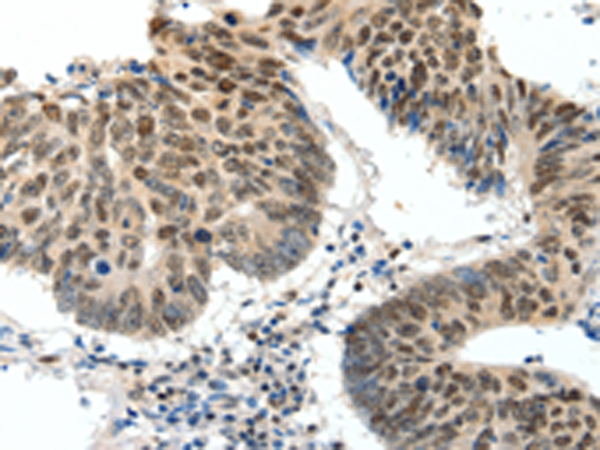 Rabbit Polyclonal Antibody to TOP2A
