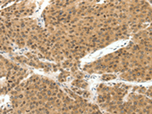 Rabbit Polyclonal Antibody to TERF2