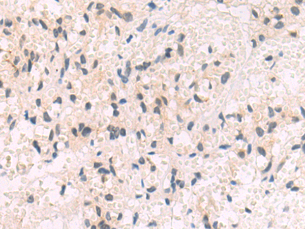 Rabbit Polyclonal Antibody to TTF2