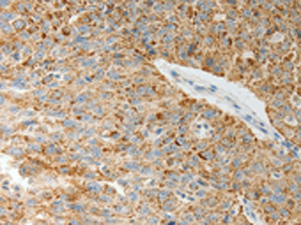 Rabbit Polyclonal Antibody to COL4A3