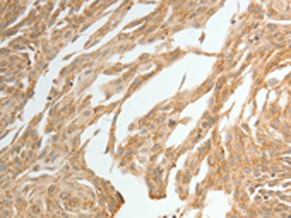 Rabbit Polyclonal Antibody to TWIST1