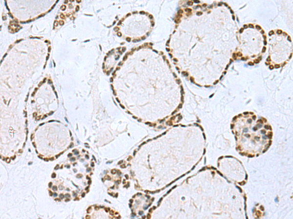 Rabbit Polyclonal Antibody to TH