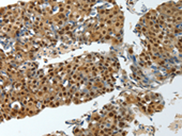 Rabbit Polyclonal Antibody to YBX1