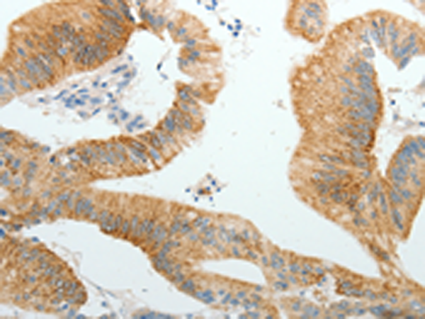 Rabbit Polyclonal Antibody to PGBD5