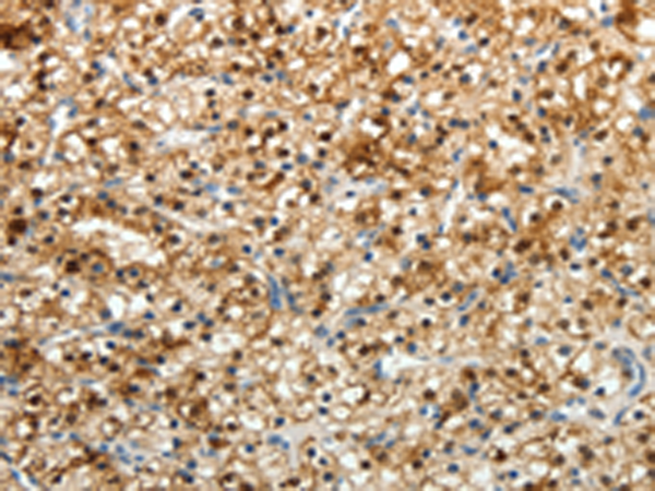 Rabbit Polyclonal Antibody to FZD2