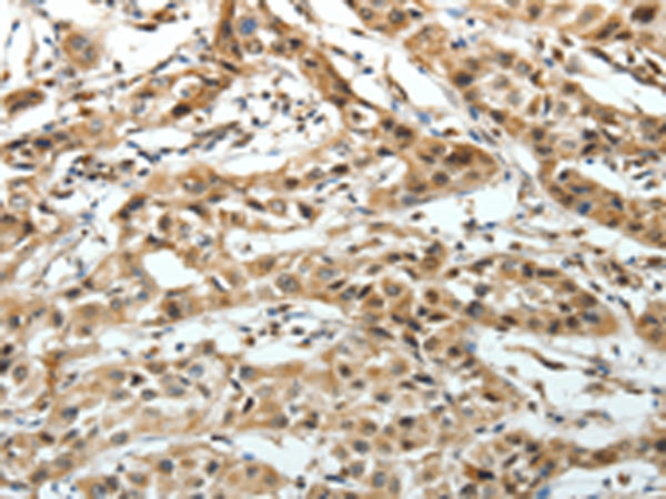Rabbit Polyclonal Antibody to FZD3