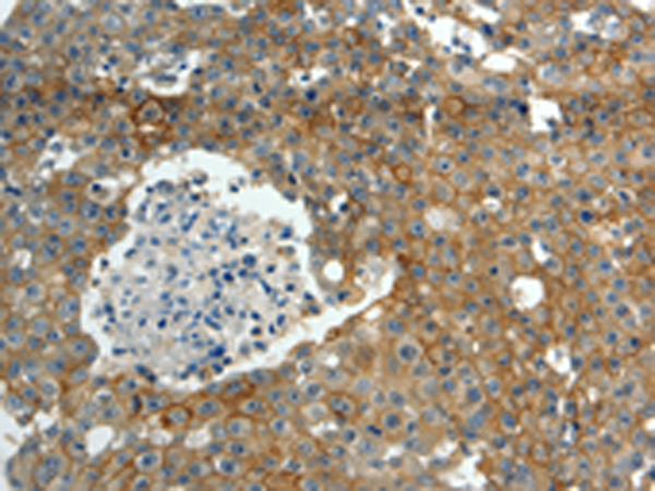 Rabbit Polyclonal Antibody to ABCC10