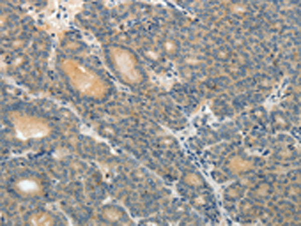 Rabbit Polyclonal Antibody to ABCC12