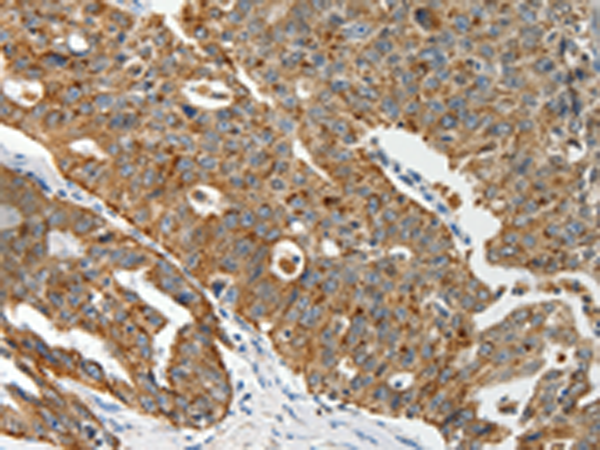 Rabbit Polyclonal Antibody to ABCD2