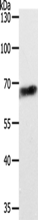 Rabbit Polyclonal Antibody to ABCD4