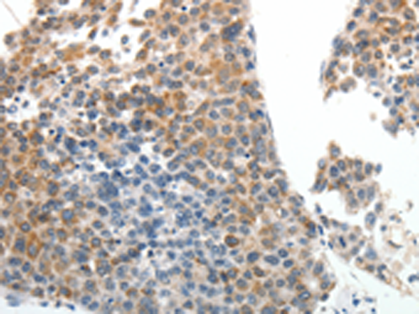 Rabbit Polyclonal Antibody to ABCG5