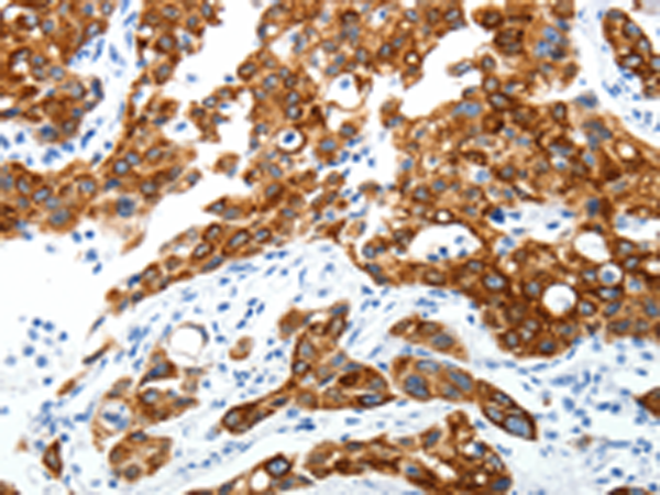 Rabbit Polyclonal Antibody to ABI3BP