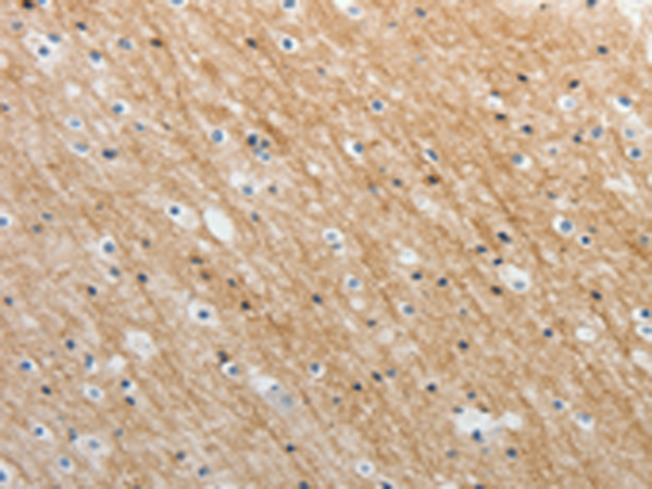 Rabbit Polyclonal Antibody to ADAMTS19