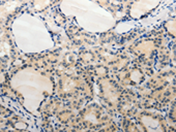 Rabbit Polyclonal Antibody to ADAMTS6