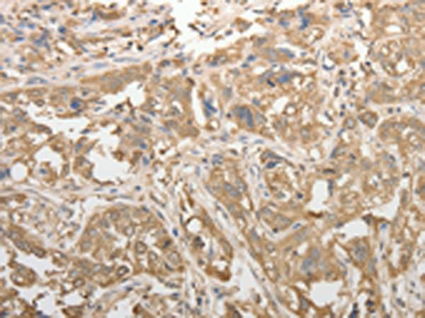 Rabbit Polyclonal Antibody to ADHFE1
