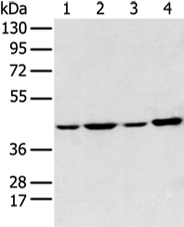 Rabbit Polyclonal Antibody to ADIPOR1