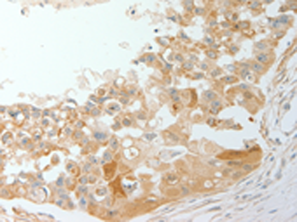 Rabbit Polyclonal Antibody to ADM