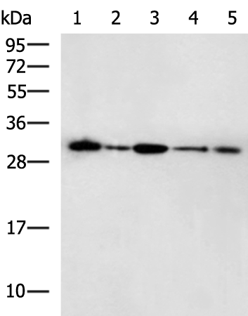 Rabbit Polyclonal Antibody to AGPAT2