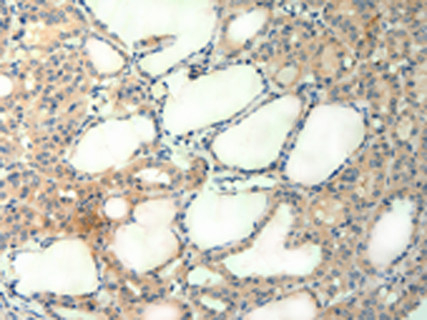Rabbit Polyclonal Antibody to AGRN