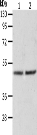 Rabbit Polyclonal Antibody to AGXT