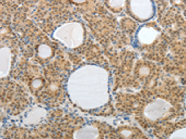 Rabbit Polyclonal Antibody to AKAP6