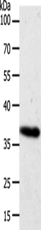 Rabbit Polyclonal Antibody to AKR1B1