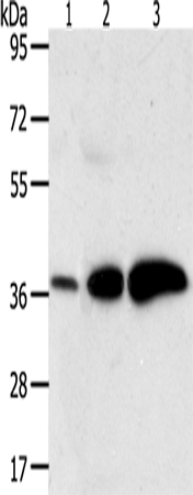 Rabbit Polyclonal Antibody to AKR1C1