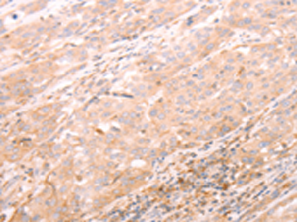 Rabbit Polyclonal Antibody to ALPG