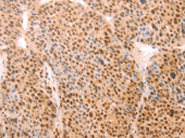 Rabbit Polyclonal Antibody to ALYREF