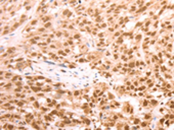 Rabbit Polyclonal Antibody to AMD1