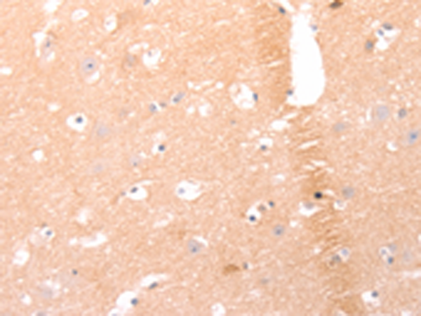 Rabbit Polyclonal Antibody to AMH