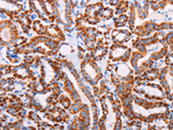 Rabbit Polyclonal Antibody to AGTR2
