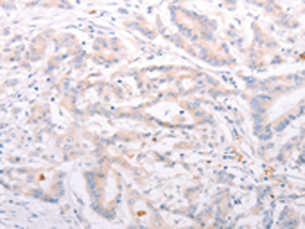 Rabbit Polyclonal Antibody to ANKRA2
