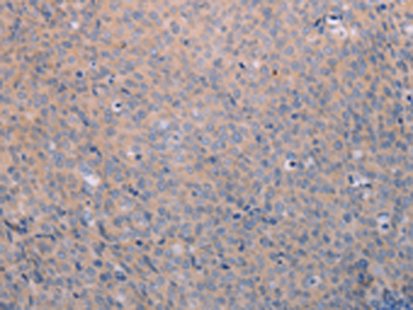 Rabbit Polyclonal Antibody to ANKRD26