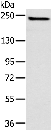 Rabbit Polyclonal Antibody to TSC2