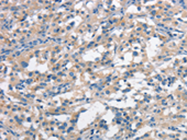Rabbit Polyclonal Antibody to ANAPC1