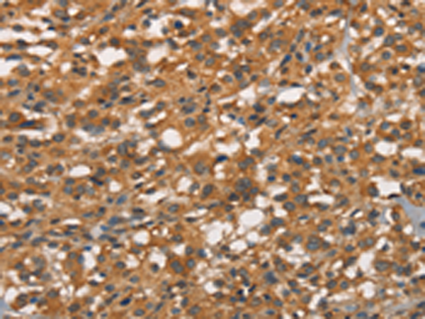 Rabbit Polyclonal Antibody to APOC4
