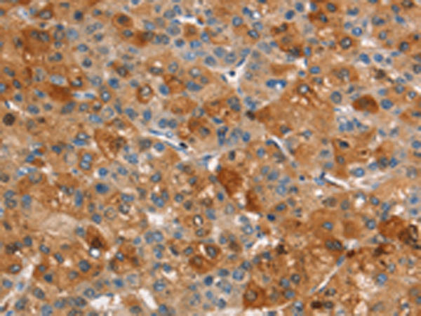Rabbit Polyclonal Antibody to ARPC2