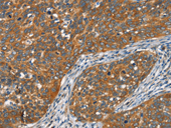 Rabbit Polyclonal Antibody to FZD1