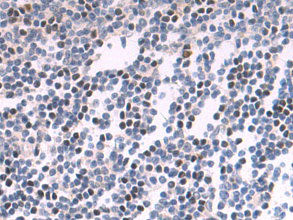 Rabbit Polyclonal Antibody to KDM6B