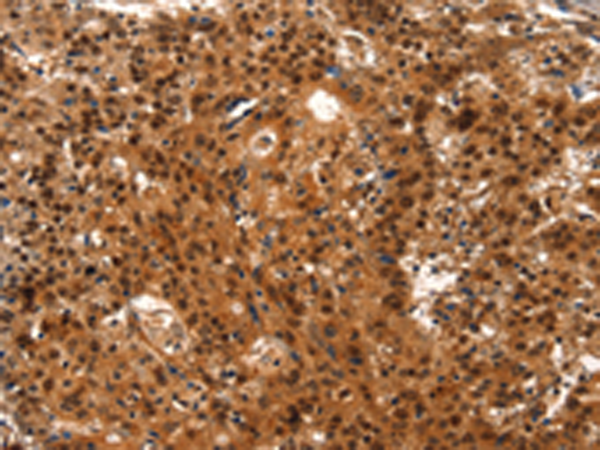 Rabbit Polyclonal Antibody to LIN28A