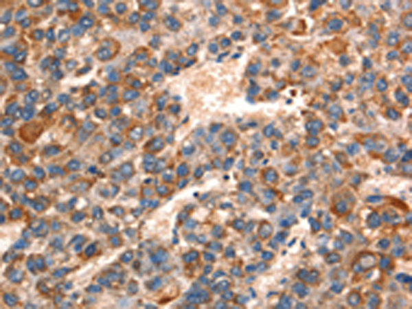 Rabbit Polyclonal Antibody to GJA8