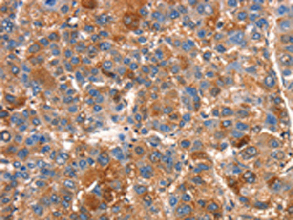 Rabbit Polyclonal Antibody to SMURF1