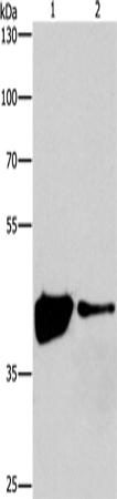 Rabbit Polyclonal Antibody to MAPK11